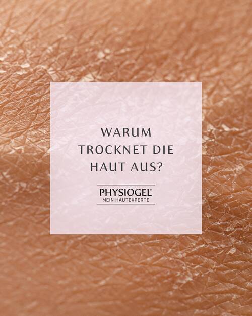 240228 Klinge Physiogel Trockene Haut Ursachen Slide01